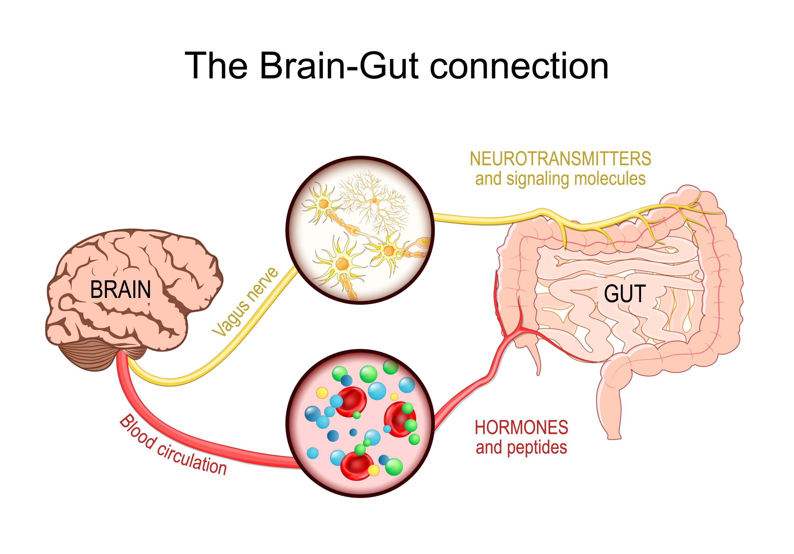 The gut and brain communicate closely — an important link when exploring possible root causes of migraine.